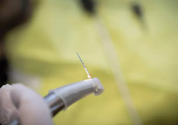 Ein Bohrer kommt beim Zahnarzt zur Kariesbehandlung zum Einsatz